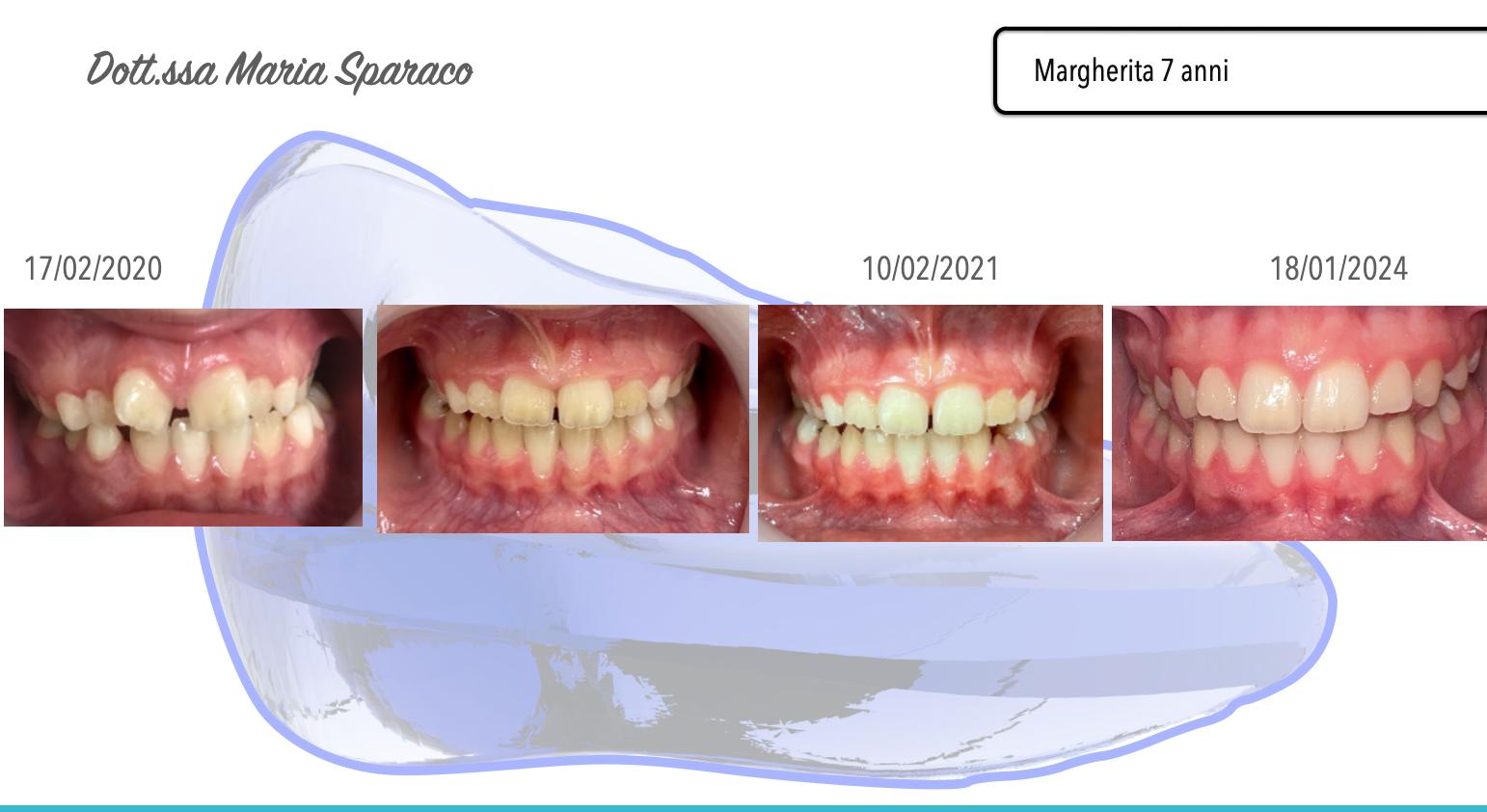 Immagine WhatsApp 2025-04-10 ore 10.22.50_53fda1be